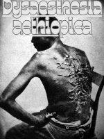 Dysaesthesia aethiopica