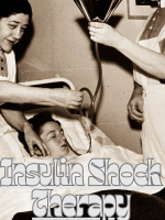 Insulin Shock Therapy